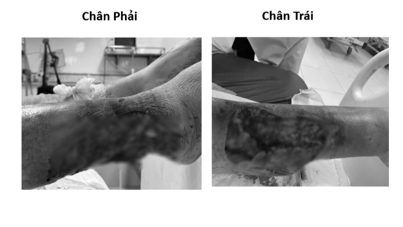 chan-phai-4733-1751511134.png