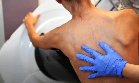 Phát hiện mới mở ra triển vọng trong điều trị bệnh ung thư vú