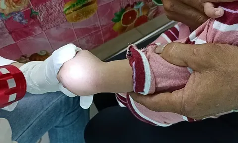 Ứng phó dịch tay chân miệng tại Cần Thơ