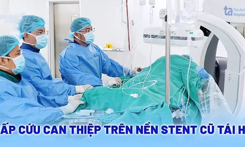 Khoan lòng mạch và đặt stent cứu sống bệnh nhân tái hẹp mạch vành nặng