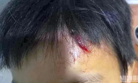 Khởi tố vụ án bé trai bị bạo hành tại Cà Mau