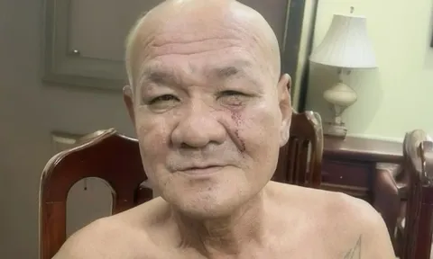 Bắt đối tượng dùng dao đâm người trên phố ở Hà Nội