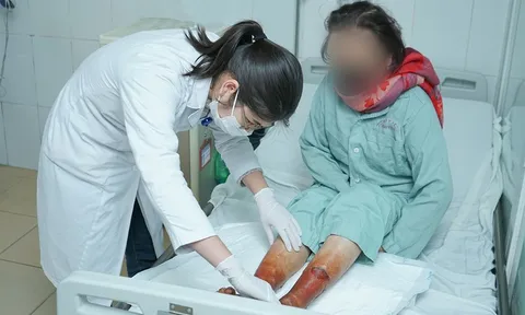 Tổn thương nghiêm trọng do ngâm chân bằng bột lá không rõ nguồn gốc