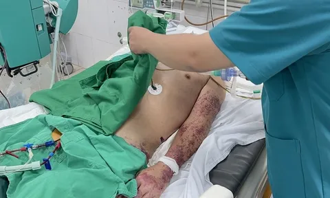 6 khuyến cáo của Bộ Y tế về phòng, chống bệnh liên cầu lợn ở người