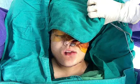 Phẫu thuật loại bỏ khối u khủng trên mặt cho người dân tộc thiểu số