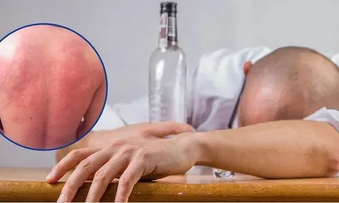 Lót dạ trước bữa tiệc thế nào để bảo vệ dạ dày, gan và giấc ngủ?