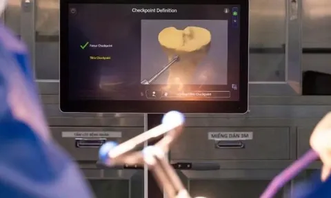 Mở rộng cơ hội phẫu thuật thay khớp gối bằng robot với chi phí hợp lý