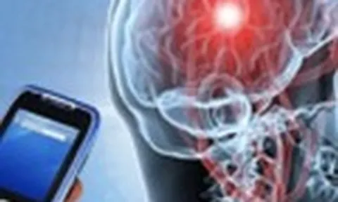 Bệnh u não có liên quan đến sóng điện thoại?