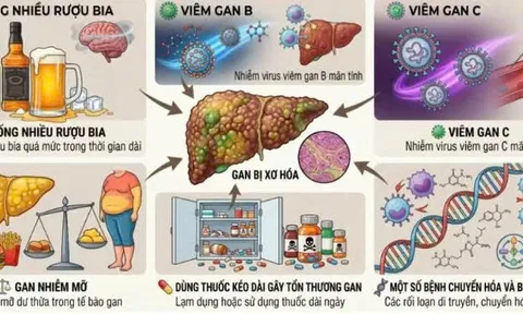 Chăm sóc người bệnh xơ gan tại nhà đúng cách để tránh biến chứng nguy hiểm