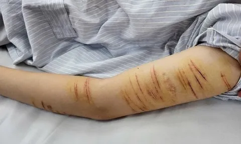 Trẻ vị thành niên và hành vi tự gây thương tích: Đừng để mạng xã hội thay thế kết nối gia đình