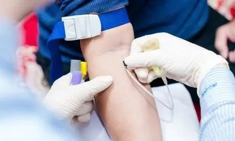 Mẹo kiểm tra trên da giúp cha mẹ phát hiện dấu hiệu nguy hiểm của bệnh não mô cầu