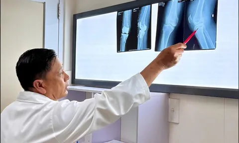 Phẩu thuật thay khớp gối cho bệnh nhân nhiều bệnh nền, phục hồi vận động sau 5 ngày