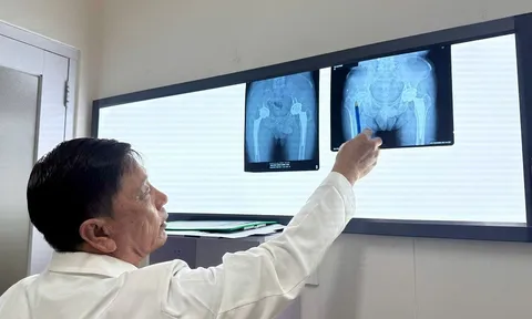 Phát hiện kịp thời và thay khớp háng thành công cho người bệnh bị hoại tử chỏm xương đùi