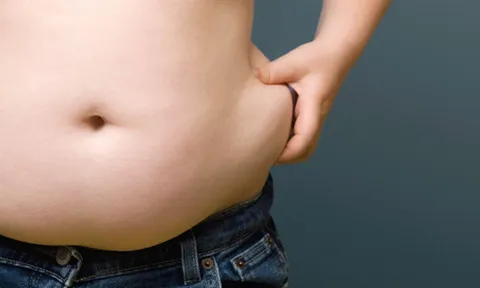 Bụng càng lớn - sức khỏe càng đáng lo: Những điều nên làm để sớm lấy lại cơ bụng phẳng lì