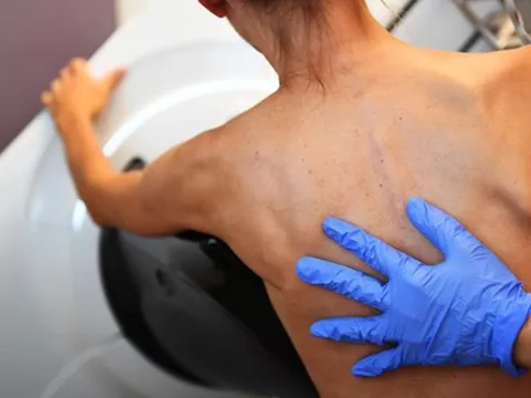 Phát hiện mới mở ra triển vọng trong điều trị bệnh ung thư vú