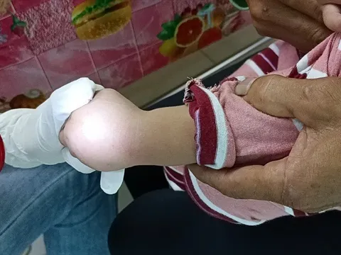 Ứng phó dịch tay chân miệng tại Cần Thơ