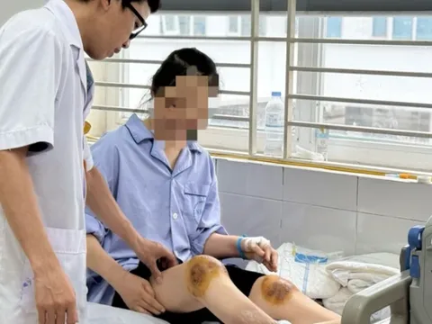 Hoại tử vùng cẳng chân vì chữa bệnh bằng phương pháp dùng ong đốt