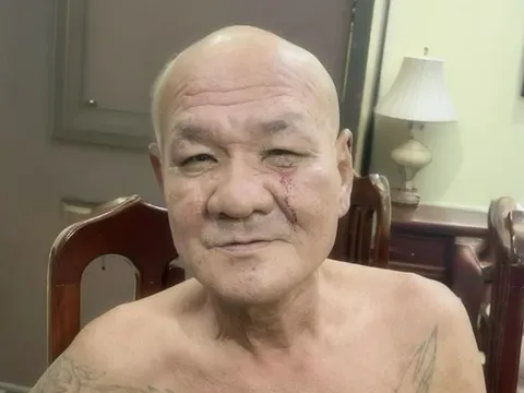 Bắt đối tượng dùng dao đâm người trên phố ở Hà Nội
