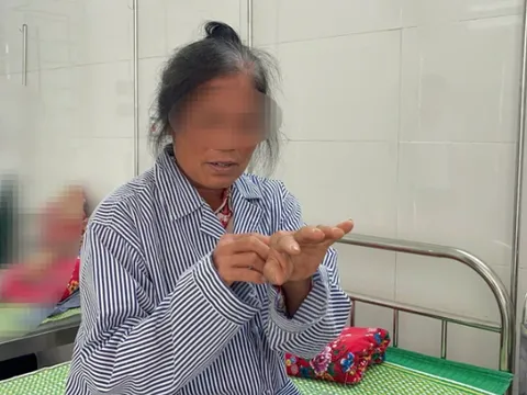 Ngứa, rối loạn tiêu hóa kéo dài mới phát hiện nhiễm sán dây chuột