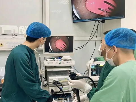Gắp thành công kẹp tóc dài 5cm khỏi dạ dày bé gái 21 tháng tuổi
