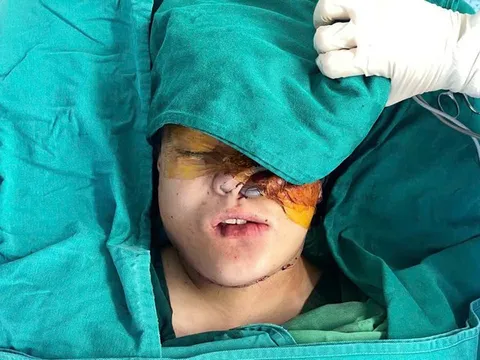 Phẫu thuật loại bỏ khối u khủng trên mặt cho người dân tộc thiểu số