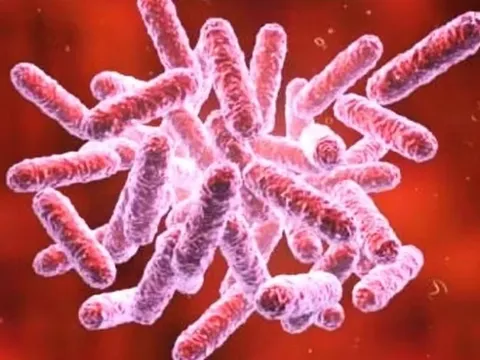 Bộ Y tế cảnh báo phòng ngừa bệnh "sốt đất"