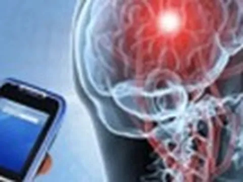 Bệnh u não có liên quan đến sóng điện thoại?