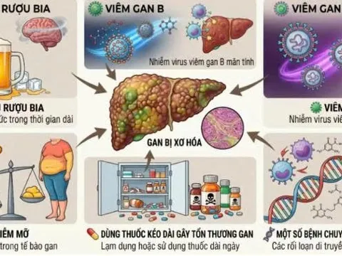 Chăm sóc người bệnh xơ gan tại nhà đúng cách để tránh biến chứng nguy hiểm