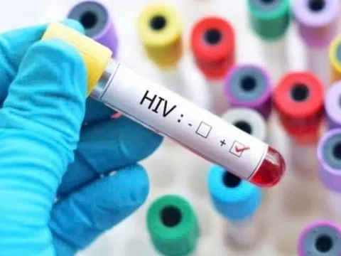 Quy định mới về cấp giấy chứng nhận bị phơi nhiễm HIV do tai nạn rủi ro nghề nghiệp