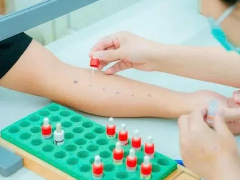 Nguy cơ khó lường từ dị ứng thuốc và thức ăn