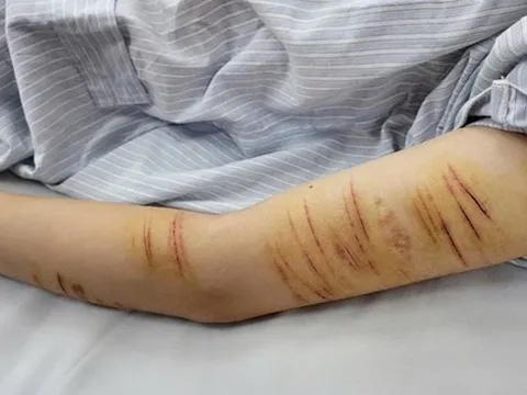 Trẻ vị thành niên và hành vi tự gây thương tích: Đừng để mạng xã hội thay thế kết nối gia đình
